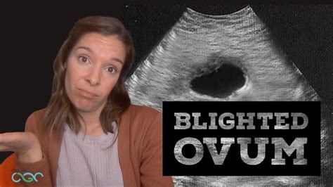 HCG even indicated that they should have seen something (it was over 11k) but my gut told me to wait a bit to make sure. . Blighted ovum miracle stories